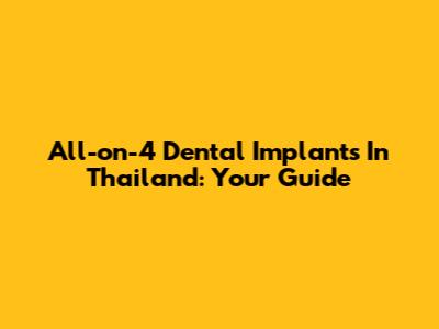 All-on-4 Dental Implants In Thailand: Your Guide