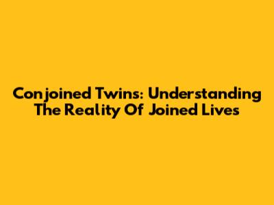 Conjoined Twins: Understanding The Reality Of Joined Lives