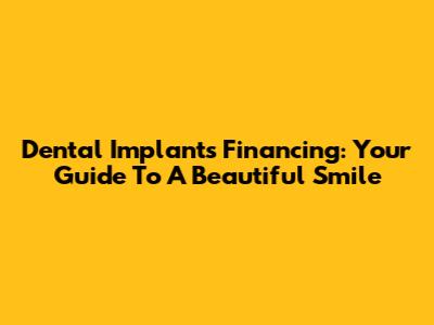 Dental Implants Financing: Your Guide To A Beautiful Smile