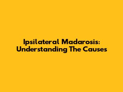 Ipsilateral Madarosis: Understanding The Causes