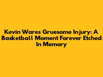 Kevin Ware's Gruesome Injury: A Basketball Moment Forever Etched In Memory