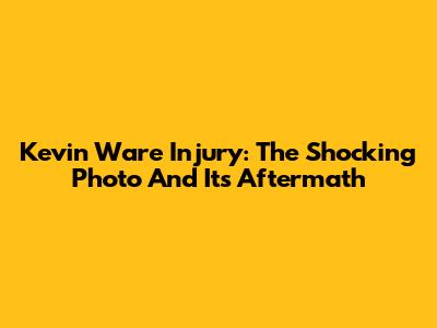 Kevin Ware Injury: The Shocking Photo And Its Aftermath