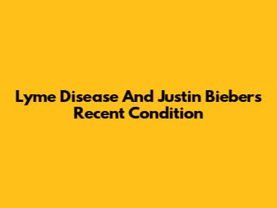 Lyme Disease And Justin Bieber's Recent Condition