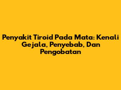 Penyakit Tiroid Pada Mata: Kenali Gejala, Penyebab, Dan Pengobatan