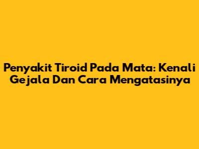 Penyakit Tiroid Pada Mata: Kenali Gejala Dan Cara Mengatasinya