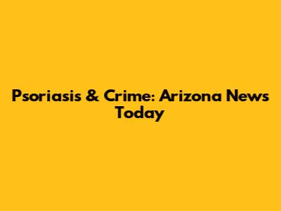 Psoriasis & Crime: Arizona News Today