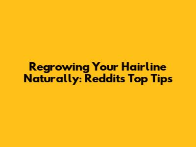 Regrowing Your Hairline Naturally: Reddit's Top Tips