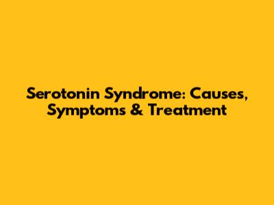 Serotonin Syndrome: Causes, Symptoms & Treatment