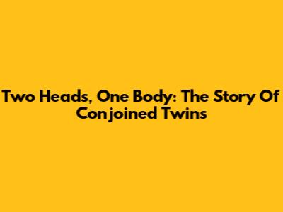 Two Heads, One Body: The Story Of Conjoined Twins