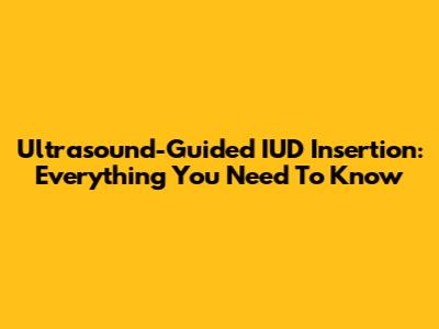 Ultrasound-Guided IUD Insertion: Everything You Need To Know